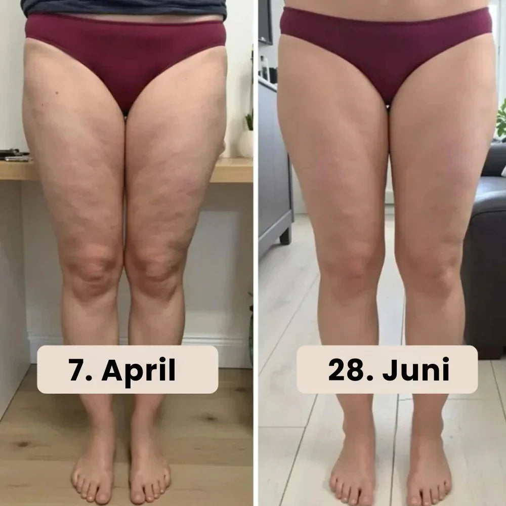 Helisandre™ - Seamless anti-cellulite leggings