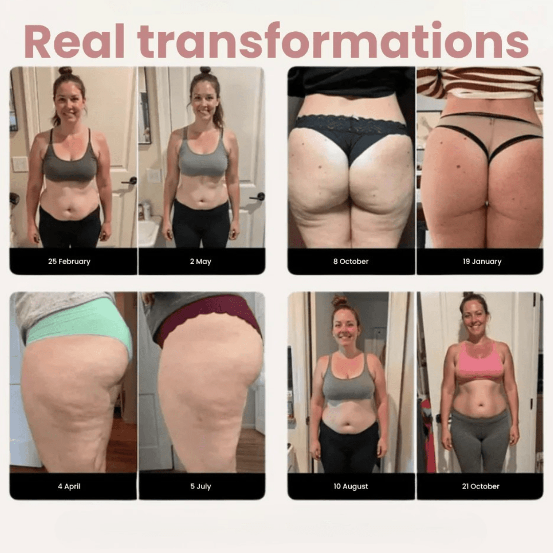 Helisandre™ - Seamless anti-cellulite leggings